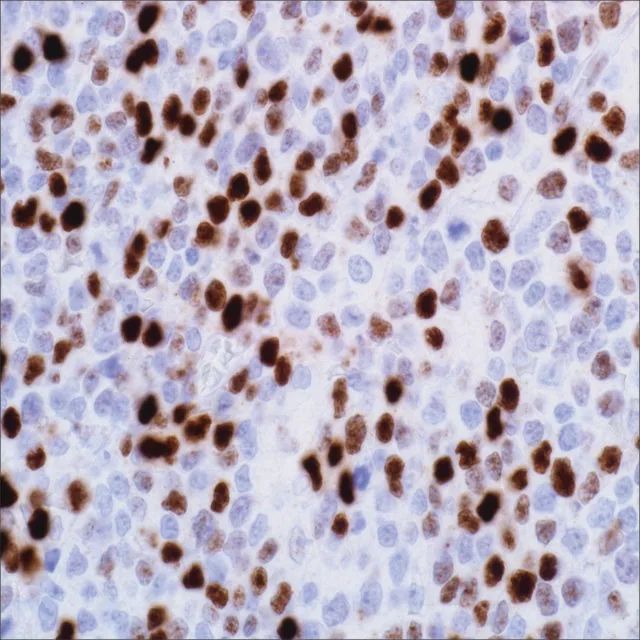 c-Myc (EP121) Rabbit Monoclonal Primary Antibody