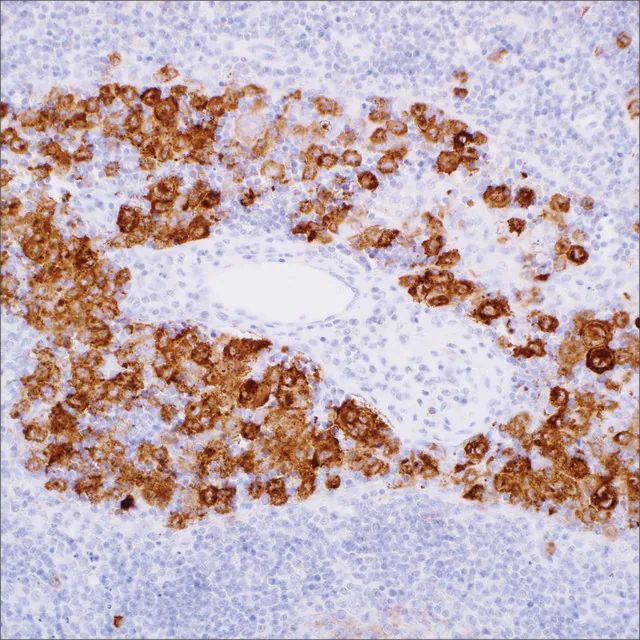 Langerin (12D6) Mouse Monoclonal Antibody