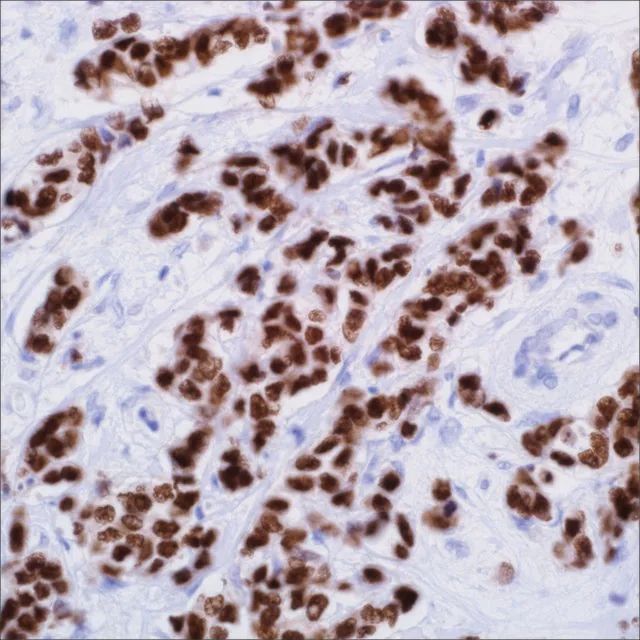 GATA3 (L50-823) Mouse Monoclonal Antibody