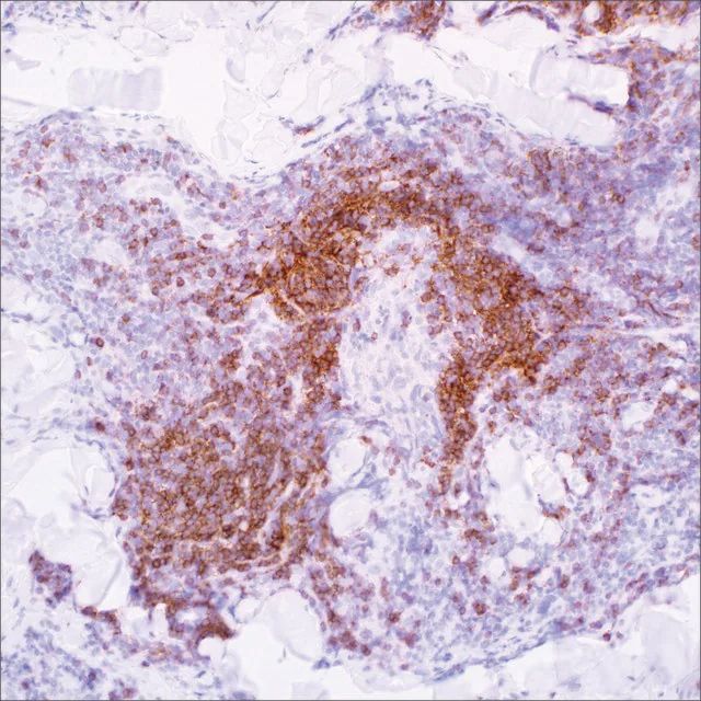 IgD (EP173) Rabbit Monoclonal Primary Antibody