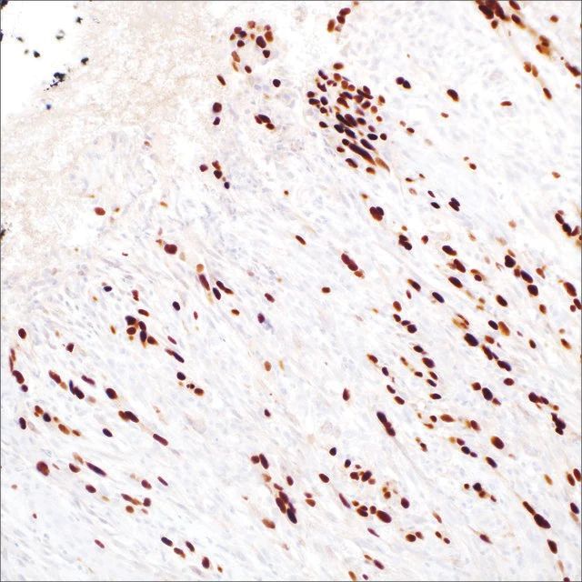 SOX-10 (EP268) Rabbit Monoclonal Primary Antibody