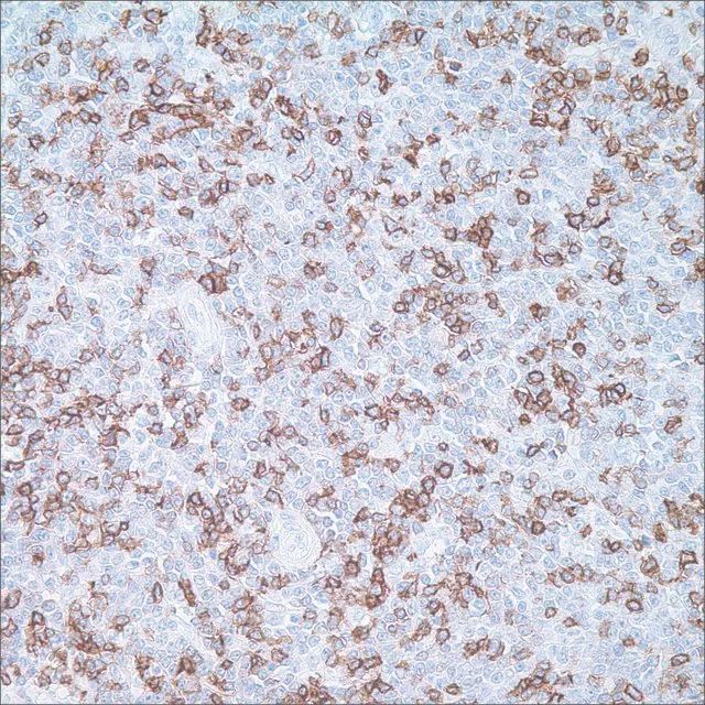 CD5 (4C7) Mouse Monoclonal Antibody