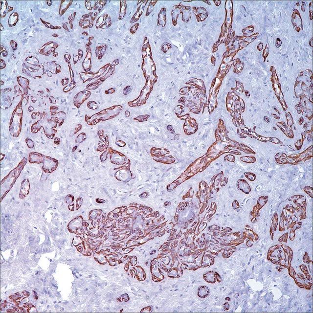 Calponin-1 (EP798Y) Rabbit Monoclonal Primary Antibody