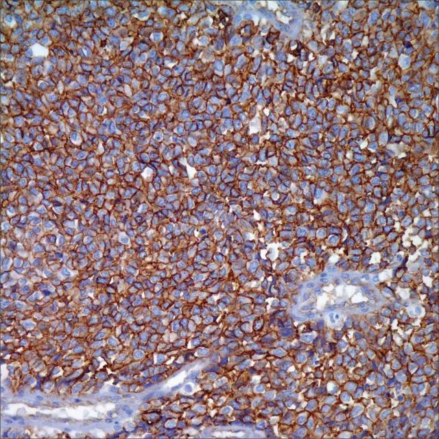 CD99 (EPR3097Y) Rabbit Monoclonal Primary Antibody