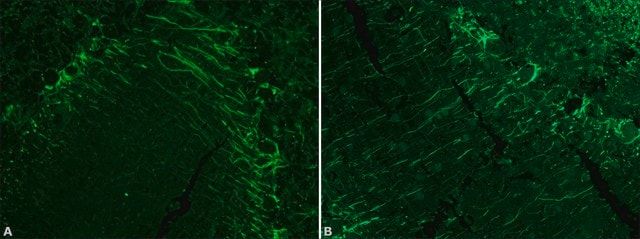 Monoclonal Anti-Neurofilament 200 antibody produced in mouse