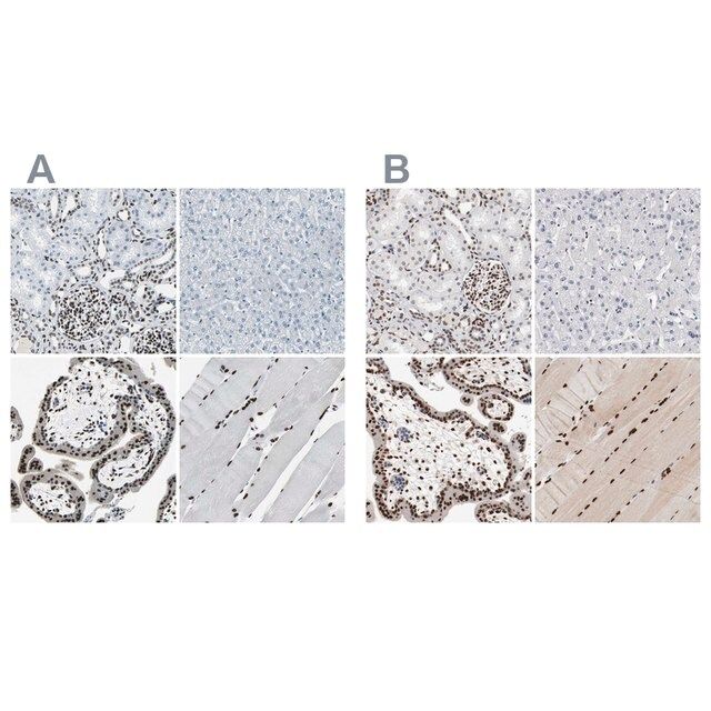 Anti-MEF2D antibody produced in rabbit
