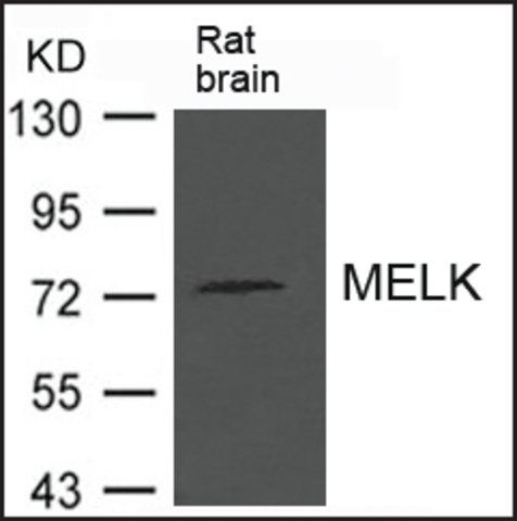 Anti-MELK antibody produced in rabbit