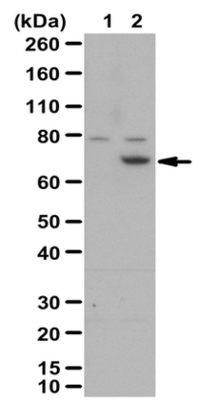 Anti-Menin/MEN1 Antibody