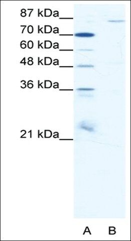 Anti-MEFV antibody produced in rabbit