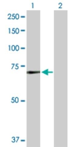Anti-MEN1 antibody produced in rabbit