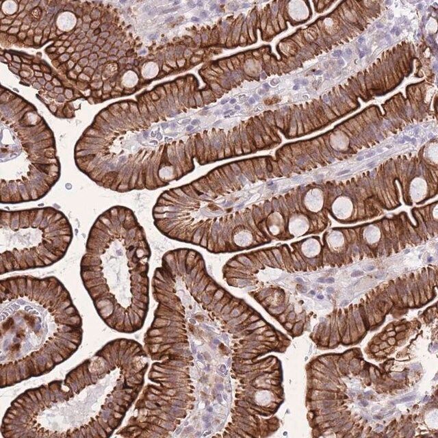 Anti-MEIS3 antibody produced in rabbit