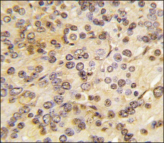 Anti-MEN1 (T594) antibody produced in rabbit