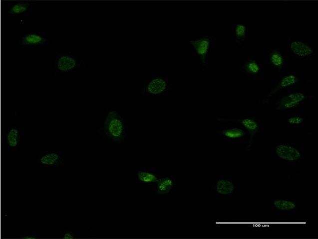 ANTI-MEOX1 antibody produced in mouse