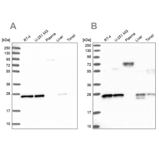 Anti-MESDC2 antibody produced in rabbit