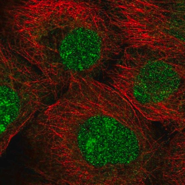 Anti-MFSD1 antibody produced in rabbit