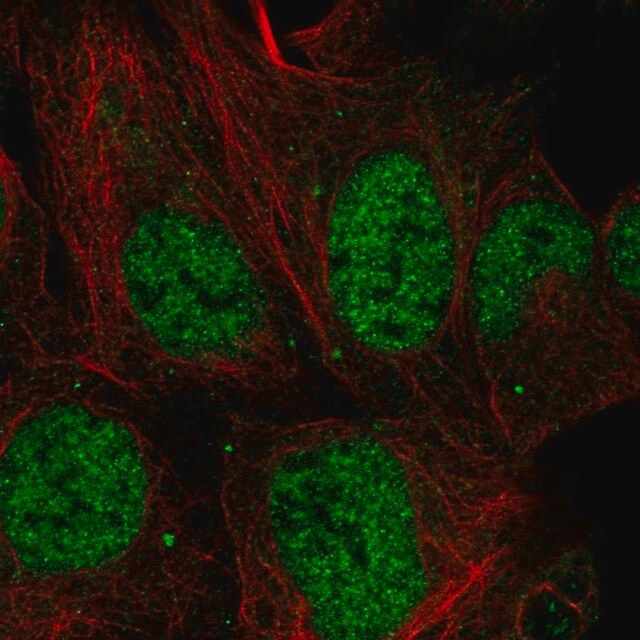 Anti-MESDC1 antibody produced in rabbit