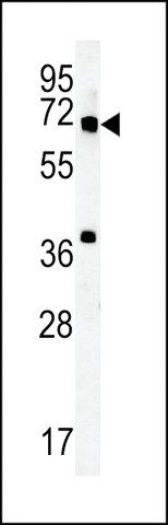 ANTI-MET10 (C-TERMINAL) antibody produced in rabbit