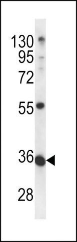 ANTI-METTL11B(N-TERMINAL) antibody produced in rabbit
