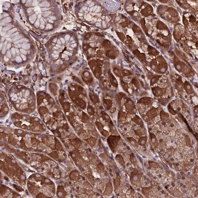 Anti-MEX3C antibody produced in rabbit