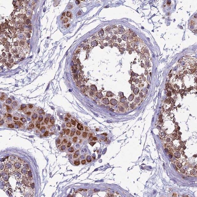 Anti-MFSD12 antibody produced in rabbit