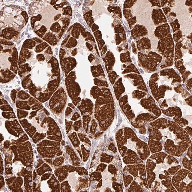 Anti-MFSD9 antibody produced in rabbit