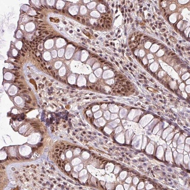 Anti-MFHAS1 antibody produced in rabbit