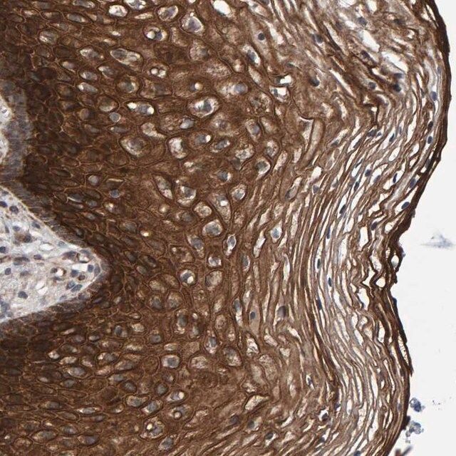 Anti-MFSD6L antibody produced in rabbit