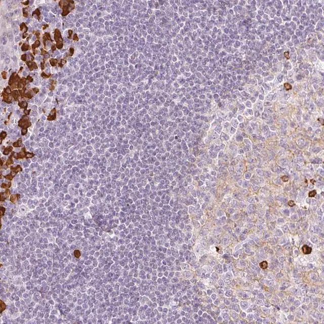 Anti-PRPF38B antibody produced in rabbit