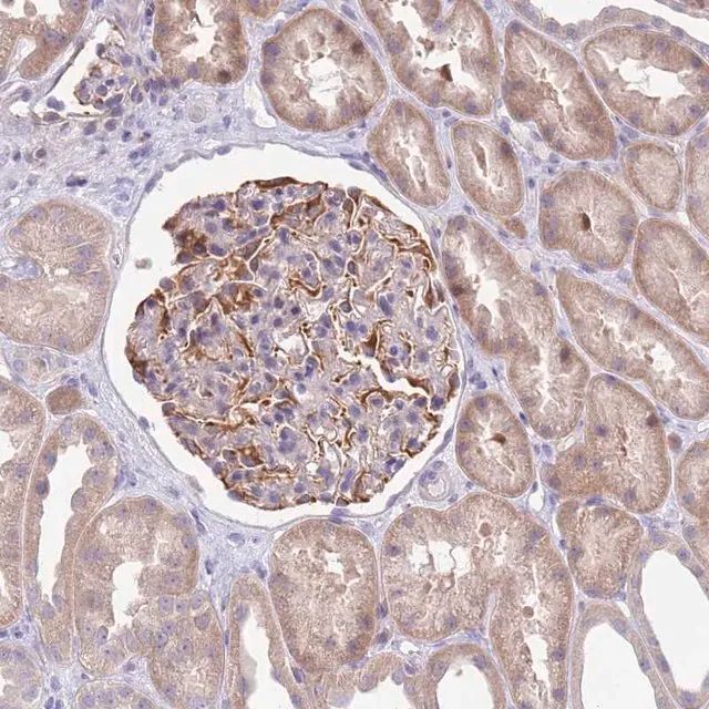 Anti-ZNF14 antibody produced in rabbit
