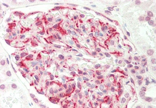 Anti-EIF6 antibody produced in rabbit