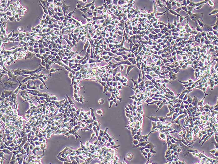 SNU398人肝癌细胞图片