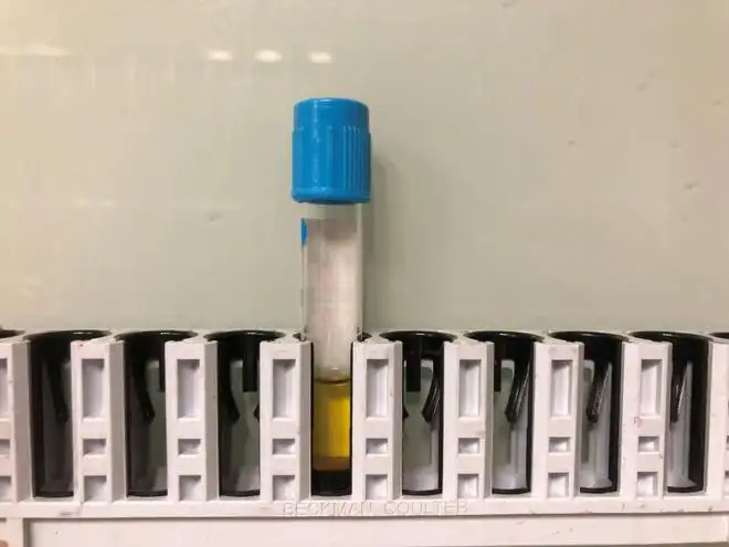 肌钙蛋白I(cTnI Antibody)图片