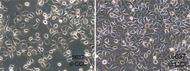 5637(HTB-9)人膀胱癌细胞图片