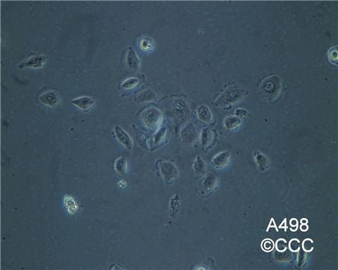 A498人肾癌细胞图片