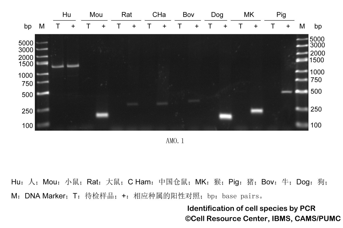 AMO-1人多发性骨髓瘤细胞图片