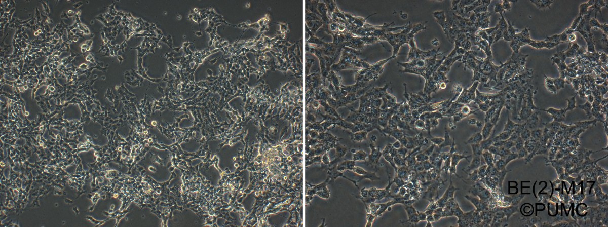BE(2)-M17人神经母细胞瘤细胞图片