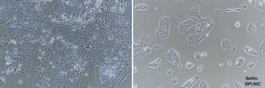 BeWo人胎盘绒膜癌细胞图片