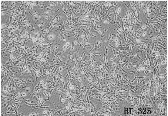 BT-325人脑多型胶质母细胞瘤细胞图片