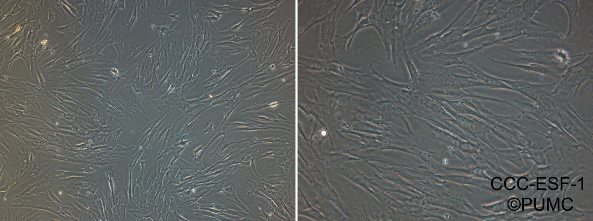 CCC-ESF-1人胚皮肤成纤维细胞图片