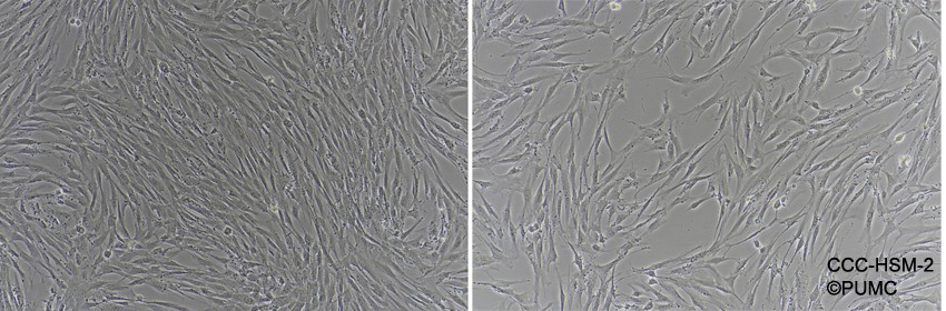 CCC-HSM-2人胚胎肌肉组织来源细胞图片