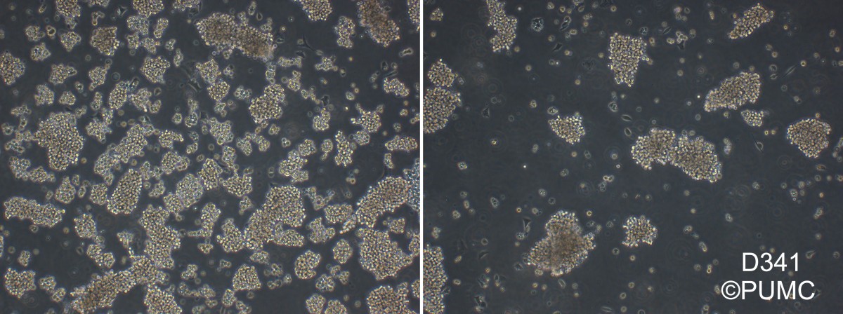 D341Med人髓母细胞瘤细胞图片