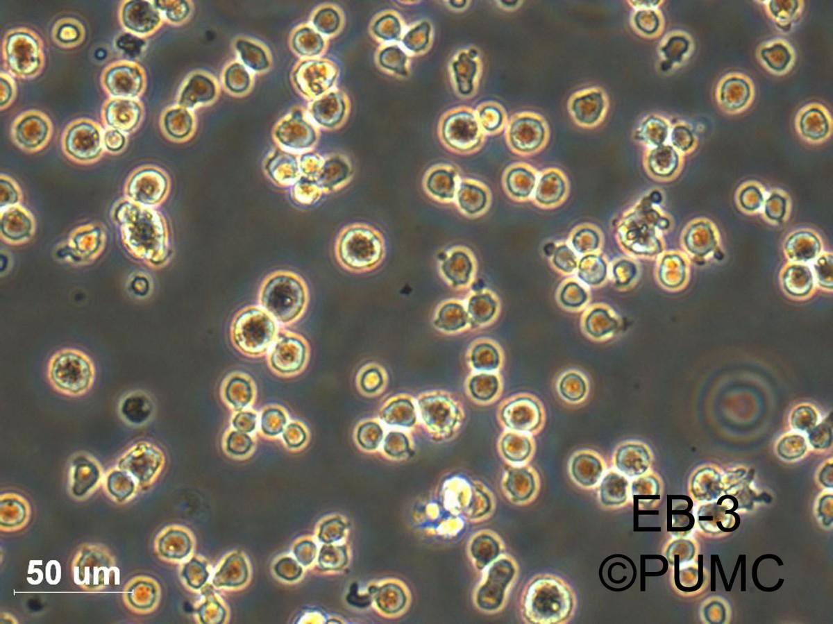 EB-3人伯基特淋巴瘤细胞图片