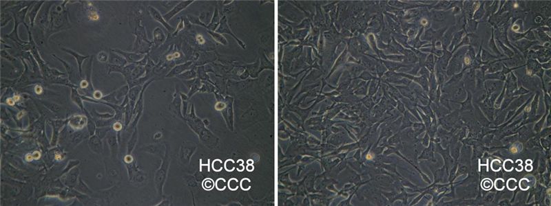 HCC38人乳腺导管癌细胞图片