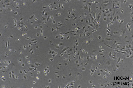 HCC-94 [HCC941122,HCC 94]人子宫鳞癌细胞(高分化)图片