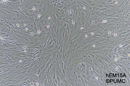 hEM15A人子宫内膜异位症患者在位内膜间质细胞永生化细胞图片