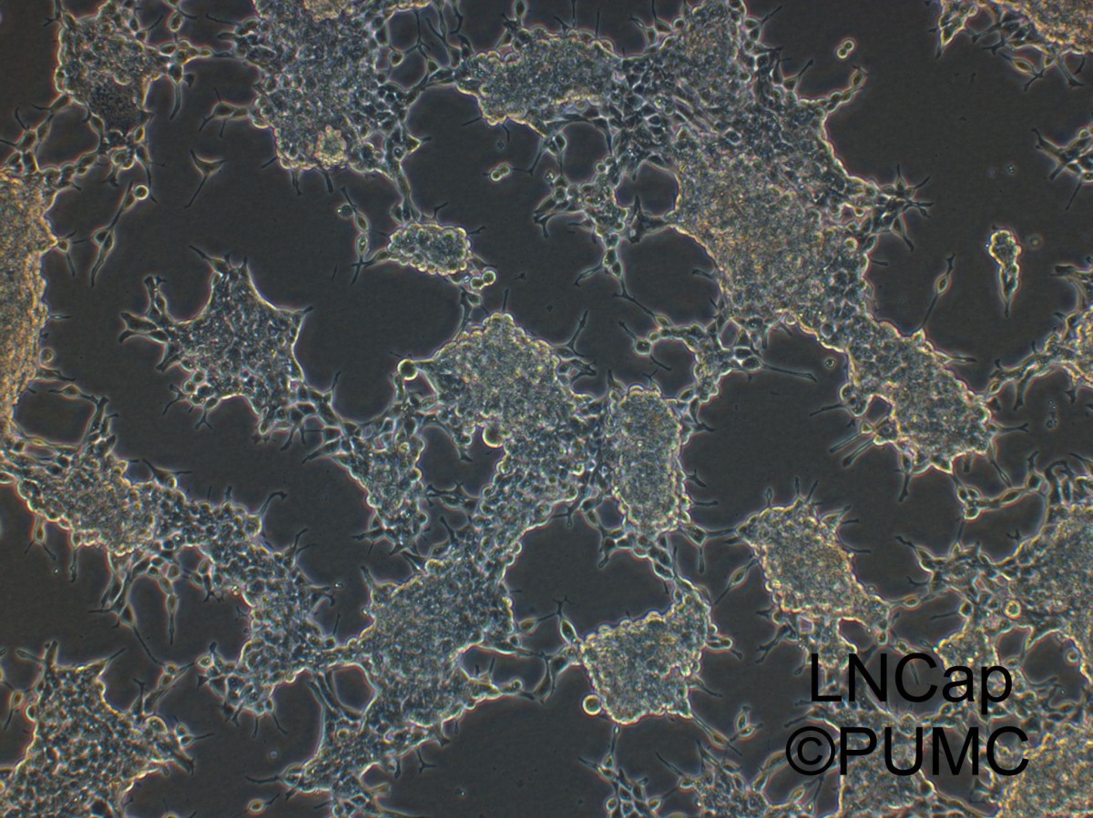 LNCaP人前列腺癌细胞图片