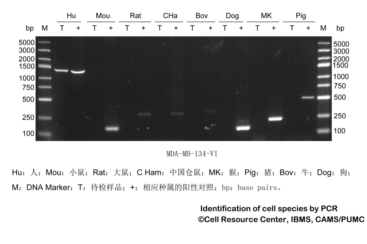MDA-MB-134Ⅵ人乳腺导管癌细胞图片