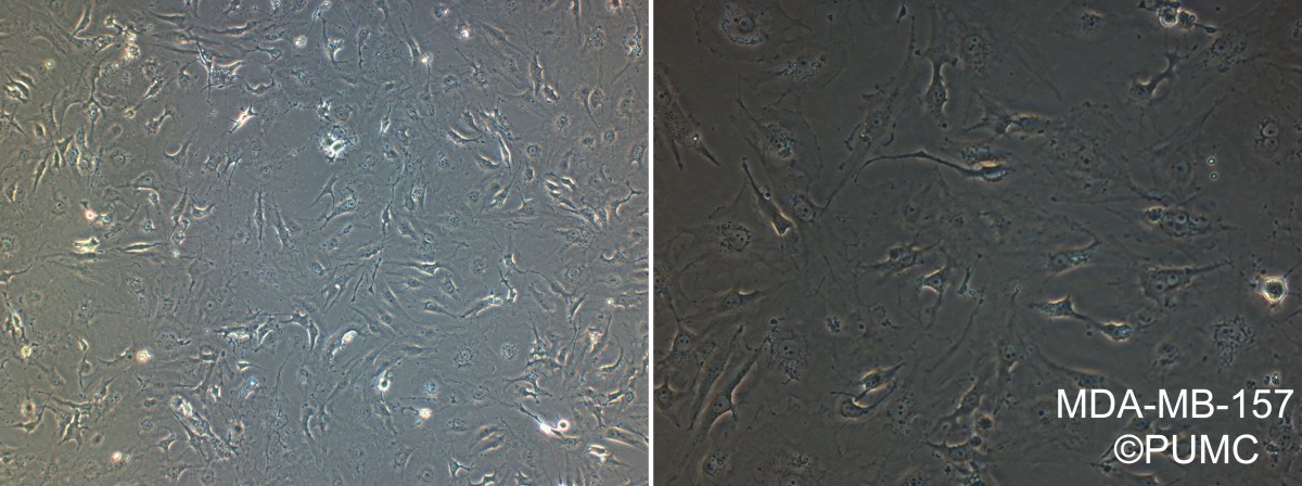 MDA-MB-157人乳腺癌细胞图片