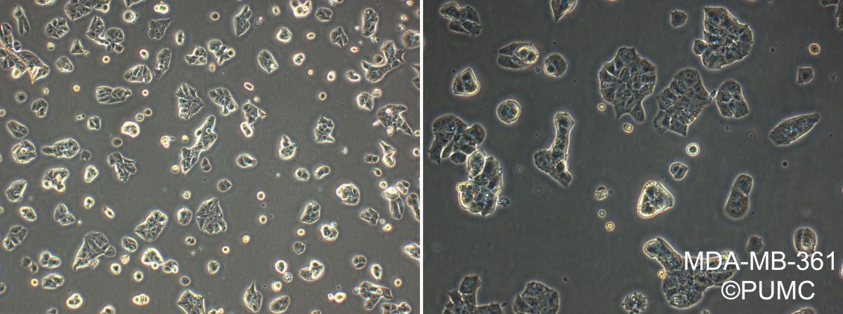 MDA-MB-361人乳腺癌细胞图片