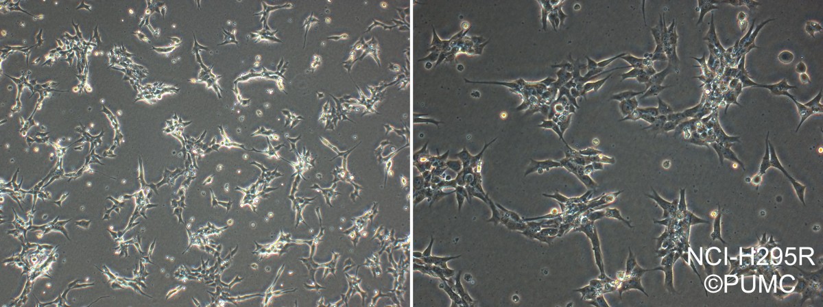 NCI-H295R人肾上腺皮质腺癌细胞图片